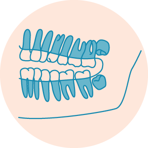 00 Impacted Wisdom Teeth MintoImpactedWisdomTeethIcons